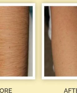 VERK GROUP Trimmer Vrouw - Gezichtsepilator - Epilator Gezicht -Philips winkel 550x350