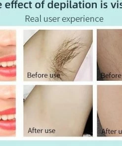 Aruvaya [Premium] - IPL Laser Ontharingsapparaat - 1.000.000 Flitsen! -Philips winkel 550x365 1