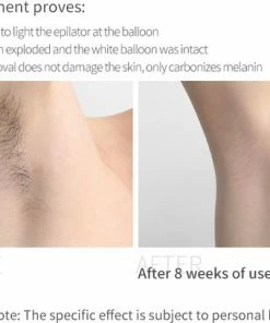 Merkloos IPL Ontharingsapparaat - IPL Lichtontharing - IPL Ontharing - Laserontharing - Ontharingsapparaat - Ontharen - Gratis Beschermbril - 999.999 Flitsen - In Zwart -Philips winkel 550x408 3