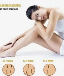 Merkloos IPL Ontharingsapparaat ? Met Beschermbril -Philips winkel 550x415 5