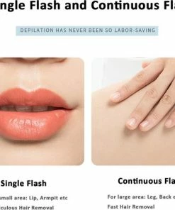 Merkloos Ontharingsapparaat Voor Vrouwen & Mannen ,flitsen Permanente ,ZEER EFFICINTE HAARVERWIJDERING -Philips winkel 550x485 6