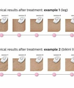Philips Lumea Comfort SC1982/00 - IPL Lichtontharing -Philips winkel 550x486 1