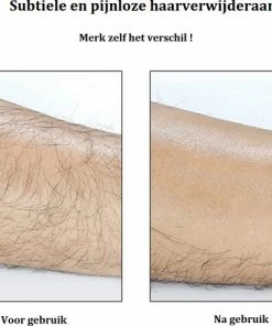 All4you Crystal Hair Remover – Ontharing – Haarverwijderaar – Scrubi – TikTok - Zwart -Philips winkel 550x491 3