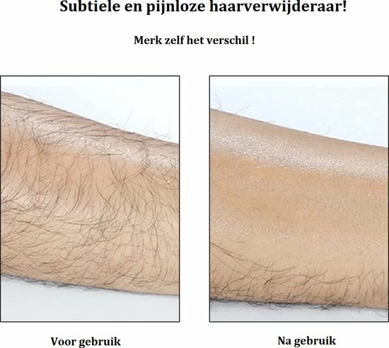 All4you Crystal Hair Remover ? Ontharing ? Haarverwijderaar ? Scrubi ? TikTok ? Roze 2 All4you Crystal Hair Remover ? Ontharing ? Haarverwijderaar ? Scrubi ? TikTok ? Roze - Afbeelding 2