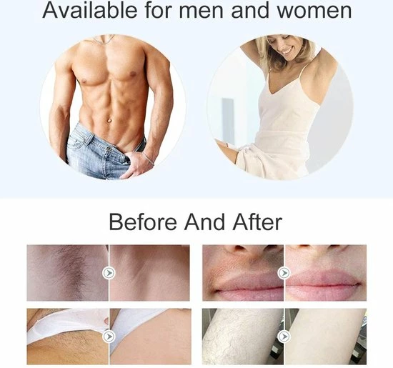 Merkloos Ontharingsapparaat Voor Vrouwen & Mannen ,Duurzame Nud Pijnloze Ontharing 6 Merkloos Ontharingsapparaat Voor Vrouwen & Mannen ,Duurzame Nud Pijnloze Ontharing - Afbeelding 6