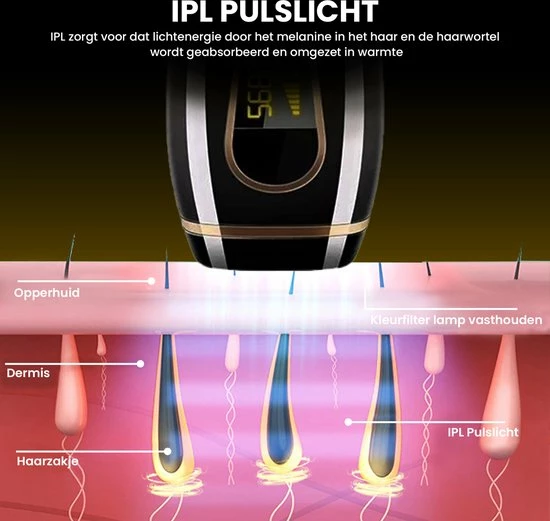 F Femmez Femmezz IPL Ontharingsapparaat - Laser En Lichtontharing - Ontharing - Inclusief GRATIS Beschermbril, Scheermes En Aloe Vera Gel 2 F Femmez Femmezz IPL Ontharingsapparaat - Laser En Lichtontharing - Ontharing - Inclusief GRATIS Beschermbril, Scheermes En Aloe Vera Gel - Afbeelding 2