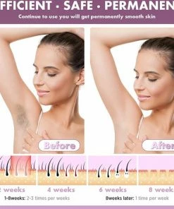 Merkloos IPL Apparaten Ontharingsapparaat Met Lichtpulsen Vrouwen En Mannen -Philips winkel 550x532 13