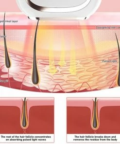 Merkloos Ontharingsapparaat Voor Vrouwen & Mannen -Philips winkel 550x533 12