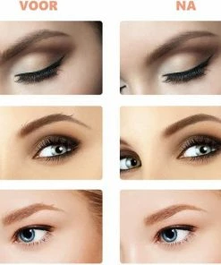 Cocora Wenkbrauw Trimmer | Wenkbrauw Epilator | Precisietrimmer | USB Oplaadbaar - Wit 5 Cocora Wenkbrauw Trimmer | Wenkbrauw Epilator | Precisietrimmer | USB Oplaadbaar - Wit -Philips winkel 550x537