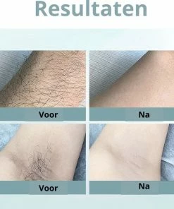 DCOVER IPL Ontharingsapparaat - IPL Ontharing - IPL Lichtontharing - IPL Ontharingsapparaat - Ontharing Laser - IPL Laser - Laser Ontharing - 900.000 Flitsen + Gratis Zonnebril & Scheermes -Philips winkel 550x546 7