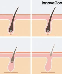 Epilator IPL Hair Remover - Revic InnovaGoods -Philips winkel 550x550 1137