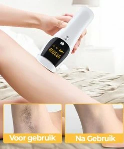 Merkloos SunLion? IPL Ontharingsapparaat - Lichtontharing - Permanent Ontharen - Laser Ontharing -Philips winkel 550x550 1276