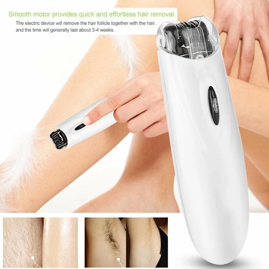 Gezichtsepilator - Bikini Epilator - Snor Epilator - Ontharing - Armen en Benen Ontharen - Snoerloos VERK GROUP Gezichtsepilator - Bikini Epilator - Snor Epilator - Ontharing - Armen En Benen Ontharen - Snoerloos -Philips winkel 550x550 227