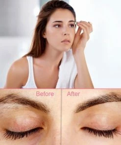 Cocora Wenkbrauw Trimmer | Wenkbrauw Epilator | Precisietrimmer | USB Oplaadbaar - Wit 4 Cocora Wenkbrauw Trimmer | Wenkbrauw Epilator | Precisietrimmer | USB Oplaadbaar - Wit -Philips winkel 550x550 307