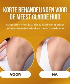 Beautyloves® IPL Ontharingsapparaat - IPL Ontharing - IPL Laserontharing - IPL Lichtontharing - Permanent Ontharen - Inclusief Veiligheidsbril En Scheermesje -Philips winkel 550x550 641
