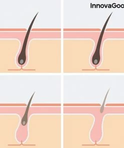 Innovagoods Innavogoods - Epilator Met Pulserend Licht En Toebehoren Ipylator - Laserapparaat Ontharen- Epileerapparaat - Hair Removal - Finishing Touch - Laser Epilator - Ontharing - Ladyshave - Cleanshave -Philips winkel 550x550 787