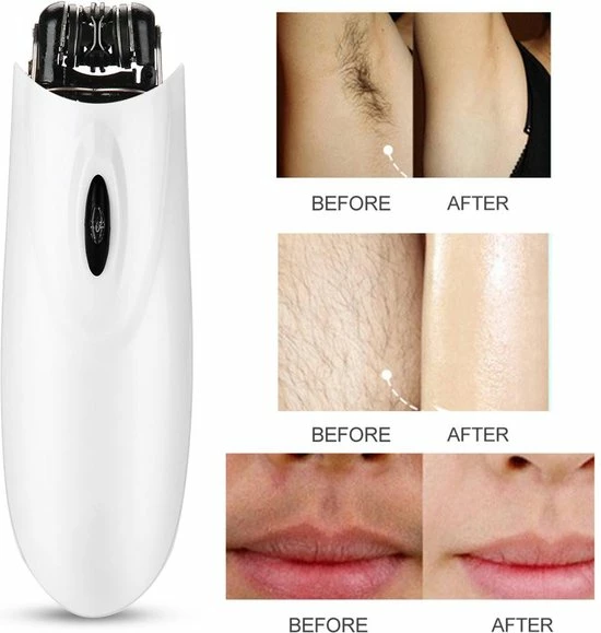 Gezichtsepilator - Bikini Epilator - Snor Epilator - Ontharing - Armen en Benen Ontharen - Snoerloos VERK GROUP Gezichtsepilator - Bikini Epilator - Snor Epilator - Ontharing - Armen En Benen Ontharen - Snoerloos -Philips winkel