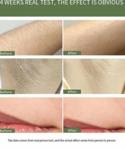 Viatel Electronics? IPL Ontharingsapparaat ? Laser Ontharing ? Met Beschermbril ? IPL Lichtontharing ? 999.999 Flitsen ? IPL Ontharing -Philips winkel 550x599 8