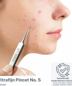 Viamart - Ultrafijn Pincet - Los Eenvoudig Huidproblemen Op: Acne, Mee-eters, Haartjes, Puistjes, Splinters En Teken