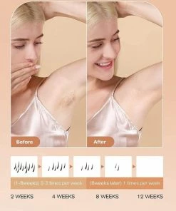 IPL Ontharingsapparaat, Thuisgebruik IPL Haarverwijderaar 999,999 Lichtimpuls & 3 Cm Ontharingsgrootte, Duurzame Ontharingsapparaat Laser Voor Lichaam, Gezicht, Bikinizone, Intieme Delen 20 IPL Ontharingsapparaat, Thuisgebruik IPL Haarverwijderaar 999,999 Lichtimpuls & 3 Cm Ontharingsgrootte, Duurzame Ontharingsapparaat Laser Voor Lichaam, Gezicht, Bikinizone, Intieme Delen -Philips winkel 550x634 11