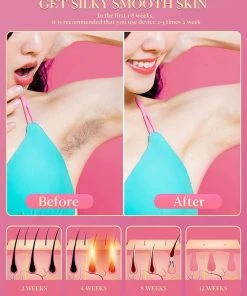 IPL Apparaten Ontharingsapparaat Met Lichtpulsen, 999,999 Ontharingsapparaat -Philips winkel 550x687 19