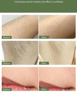 Viatel Electronics? IPL Ontharingsapparaat ? Laser Ontharing ? Met Beschermbril ? IPL Lichtontharing ? 999.999 Flitsen ? IPL Ontharing -Philips winkel 550x811 3